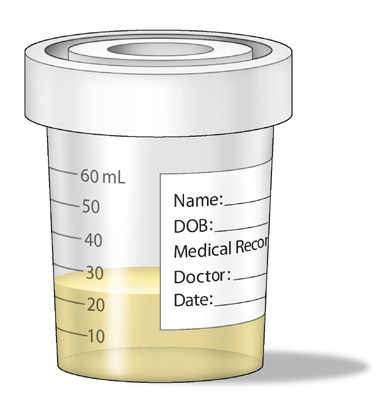 Samle 20-30 ml urin i et rent beger