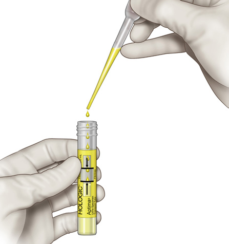 Overfør urin til prøverøret med pipette