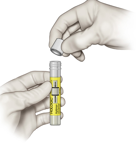 Skru av lokket på det gule prøverøret